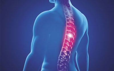Spinex Spine Care International  