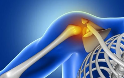 Spinex Spine Care International  
